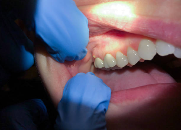 Best After-Hours Emergency Dentist in Lathrop, MO